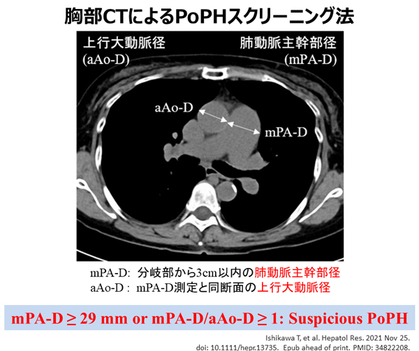 PubMed論文掲載報告 ~Hepatology Research誌:筆頭著者 石川 剛准教授~