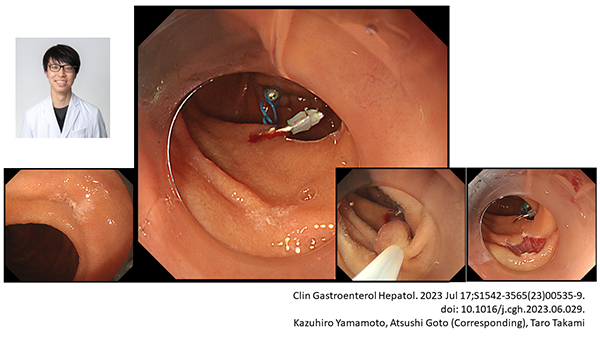 PubMed論文掲載報告 ～Clin Gastroenterol Hepatol. (IF13.576)：筆頭著者 山本一太～