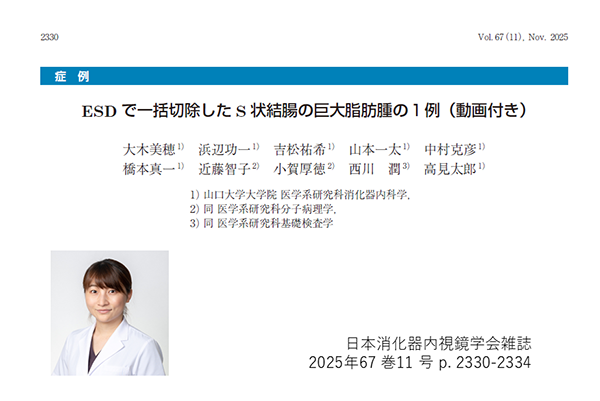 論文掲載報告～日本消化器内視鏡学会雑誌：筆頭著者 大木美穂～