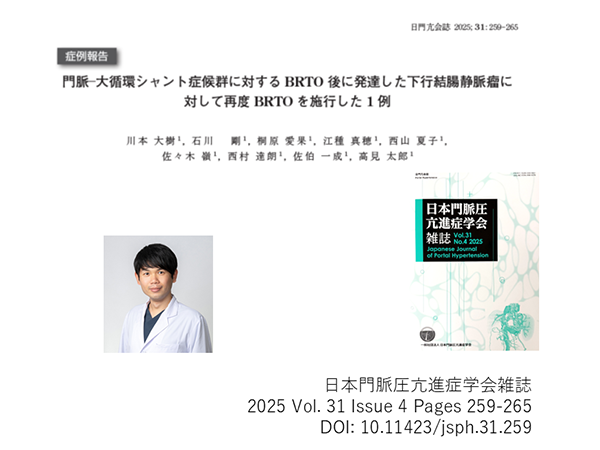 論文掲載報告【筆頭著者 川本大樹：日本門脈圧亢進症学会雑誌 (2025年31巻4号 p. 259-265)】